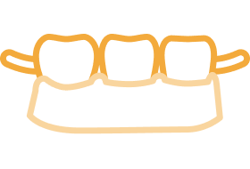 入れ歯・義歯